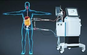 First HIPEC Surgery at SDM Dharwad | Dr. Pavan Kumar C G
